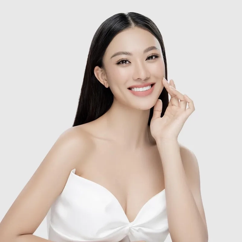 Kim Duyên phẫu thuật thẩm mỹ có phải bí quyết nhan sắc